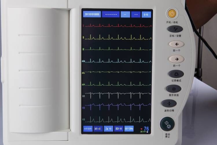 인간 ECG 기계 심장 검사 심리 12 채널 ECG 기계 ECG 전기 심혈관 기계 ECG