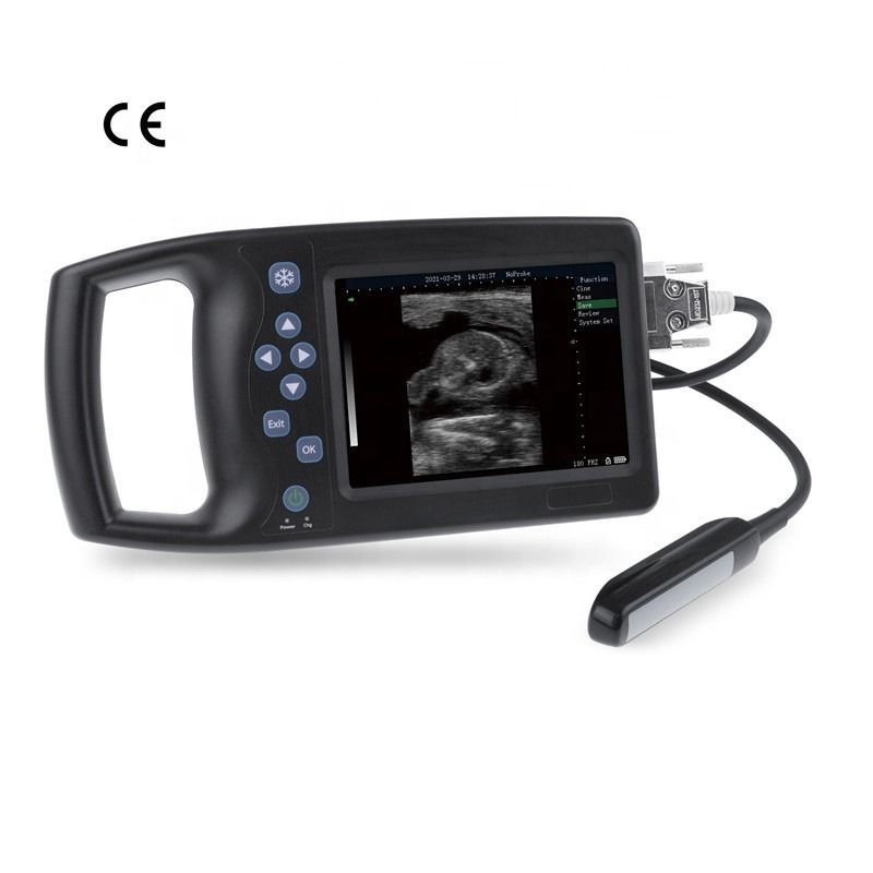B 5.7 인치 수의사 초음파 휴대용 동물 격리 휴대용 디지털 수의사 초음파 기계 수의사 초음파 스캐너